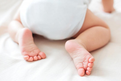 5 Cara Atasi Ruam Popok pada Anak